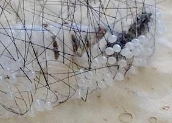 Anestia ombrophanes eggs